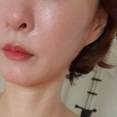 이엔아이지힐링디톡스센타 네이버블로그