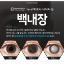 글로리서울안과의원 네이버블로그
