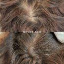 미담케어 이미지