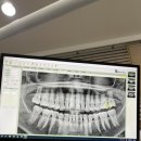 연세고은의원 이미지