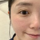 메디아토 | 성인아토피 관리 방법 | 아토피원인과 멀티밤 위메디밤 후기