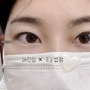 미인만들기 | 가평 미인점 시술 후기 – 매력 있는 포인트 만들기/a