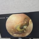 서울보청기 전문센터 이미지