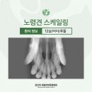 훈동물병원 | 좌동 동물병원, 12살 노령견 스케일링 후기 (치아 방사선·고압산소)