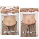 아름다운 피부샾 | 평택 피부관리 피오렌에스테틱 뼈말라 복부관리