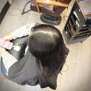 도봉-도봉-서울도봉-2207 | 율전동 아엠헤드] 서울 도봉구 방학동에서 찾아온...정수리 볼륨 링거펌으로 해결한 20대 여성 리얼 후기