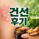 남구-105 | 인천중구건선 후기 / 부산남구건선 후기 (무료샘플)