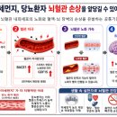 당뇨 환자, 초미세먼지 노출 시 뇌혈관 손상 더 뚜렷 이미지