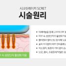 아그네스 이미지