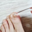 진네일 | 바름 뉴트리토 리페어 앰플 발톱영양제 발톱케어 후기, 네일 후 약해진 손발톱 관리