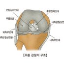 퇴행성관절염(펌) 이미지