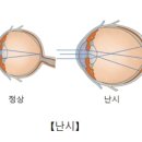 빠리안경원 이미지