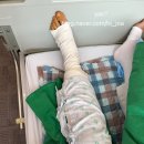 천안센텀정형외과신경외과병원 | 무릎 거대세포종 천안센텀수술 서울대소아정형외과 김한수교수님 진료까지