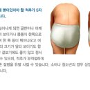 바디체인지체형교정 이미지