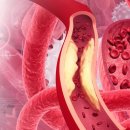 건강검진 결과 LDL 콜레스테롤 수치 높다? 관리 열쇠는 ‘순환과 배출’ 이미지