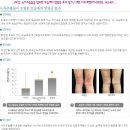 아토원 Daum카페