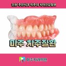 주안치과기공소 티스토리