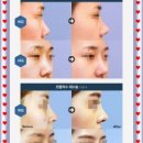 유노성형외과