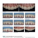 박민주치과의원 | 치과계 잡지에 기고문을 투고하였습니다.