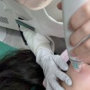 부산마이크로병원 | 부산 피부과 추천 부산포텐자 1회차 솔직후기 통증 효과 부작용 - 2주 경과 기록