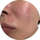 한되 | 세르프 한 달 후기｜효과 없는 줄 알았는데 4주차에 반전이 왔다