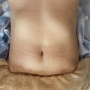 미미에스테틱 | 대구 침산동 피부관리샵 미미에스테틱 복부관리 마사지 후기