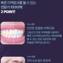 분당하얀치과의원 네이버블로그