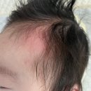 보습으로 진정케어 보타니컬테라피 리프세라 베이비로션 후기