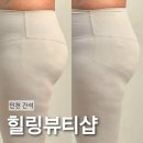 간석로 | 간석동 피부관리 힐링뷰티샵 체형관리 후면 골반테라피 후기와 B&amp;A