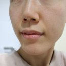 아라연 | 아라연 스파퍼밍 마스크팩 후기