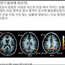 대략난감, 트롤리딜레마 이미지