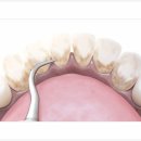 광안뉴욕치과의원 이미지