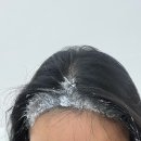 합정 유주얼 | 여자 탈모 드라마틱한 반영구 후기 | 헤어라인반영구