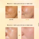 신데렐라화장품 - 구미시 백산로 145 | [기미크림] 주근깨/잡티 에 좋은 ‘ 비플러스솔루션 신데렐라 매직크림 ’ 솔직후기 🤍