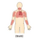 심장 질환일까요?....서울아산병원 심장내과 강도윤 교수님편 이미지