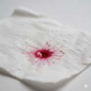 무안-7 | 치질증세 항문출혈 무안치질 2개월 후기