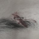 서울화봄의원 이미지