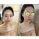 수원 영통 피부관리 ‘포이에마’에서 웨딩관리 수분케어 받고 왔어요 (내공 어마어마함)
