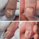 네일후에 | 신사역 논현역 네일아트 젤네일 후 큐티클 관리 후기