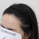 더헤어라인성형외과의원 이미지