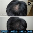 창동 두피문신 잘하는 곳을 찾고 계시나요? 추천 디모드노원점