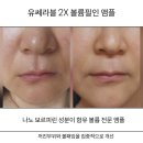 유쎄라블 2X 볼륨필인 앰플 사용 후기