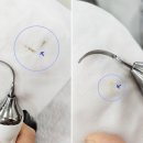 브니엘메디칼 이미지