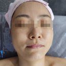 사바비안양주 | 옥정 피부관리 사바비안 스페셜 미백케어 후기