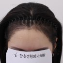 한올성형외과의원 이미지