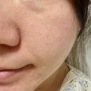 포텐자 후 피부장벽 케어에 쓴다는 EFG재생크림 환절기 수부지도 괜찮을까? 지피덤 바이오크림 후기