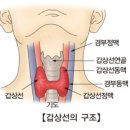 갑상선암 바로 알기 이미지