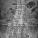 평촌올바른마취통증의학과의원 이미지