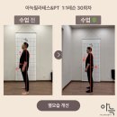수정-41 | 송도필라테스, 수술은 끝났는데 팔은 안 올라갔던 이유 (41회 후기)