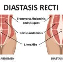 바른습관PT 이미지